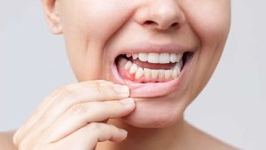 النظام الغذائي المتوسطي: فوائد لصحة الفم واللثة